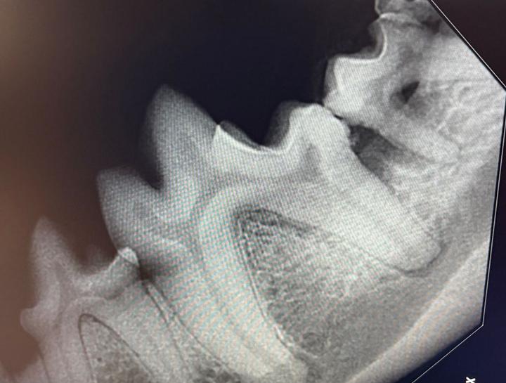 Digital Dental Radiology